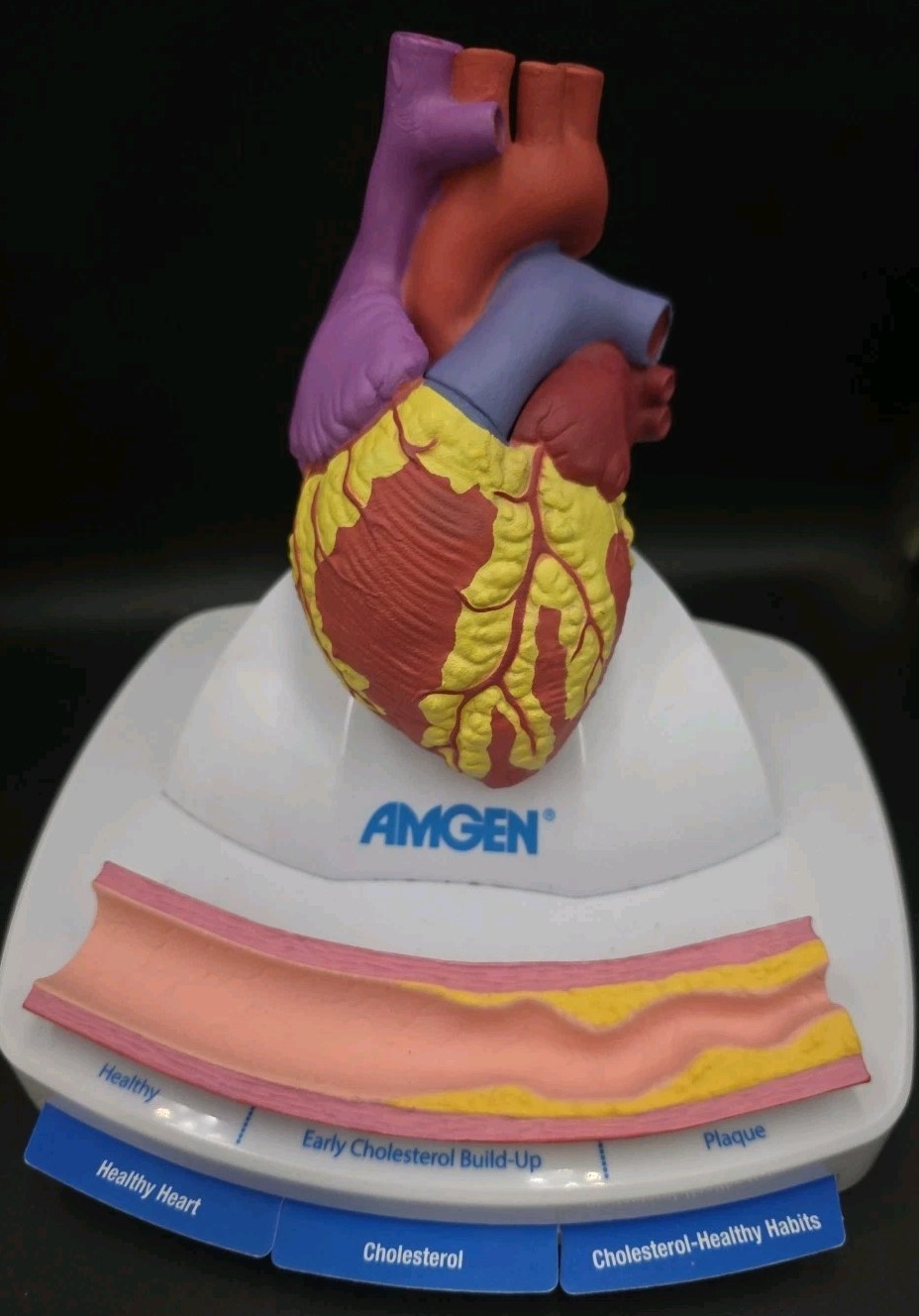 Xarelto 3D Human Heart Lighted, 3B & Amgen Display Models – Doctors Office
