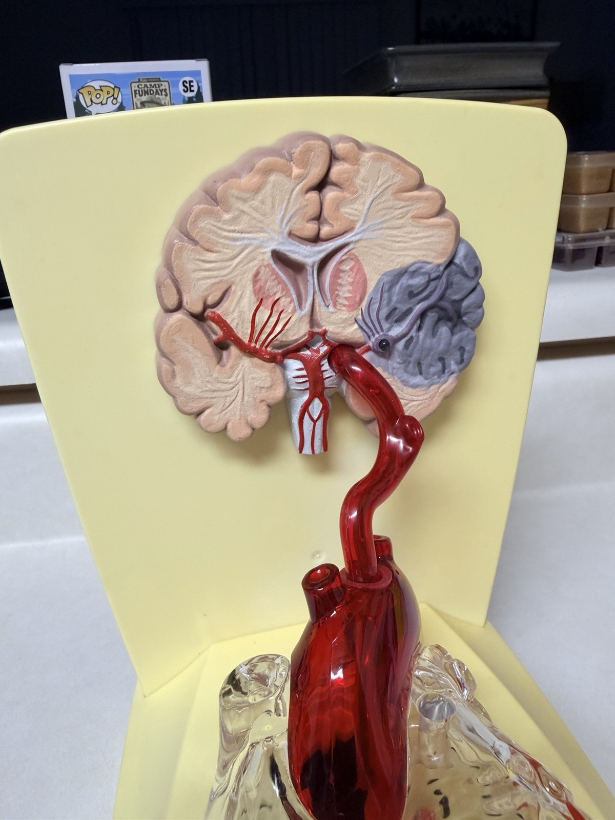 Xarelto Pharmaceutical Advertising 3D Human Heart/brain Lighted Display Model